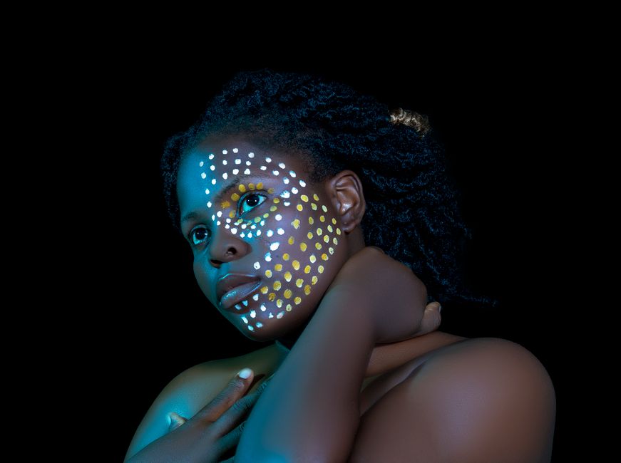 How Do I Fade Dark Spots Left Behind by Acne Without Making Them Worse?