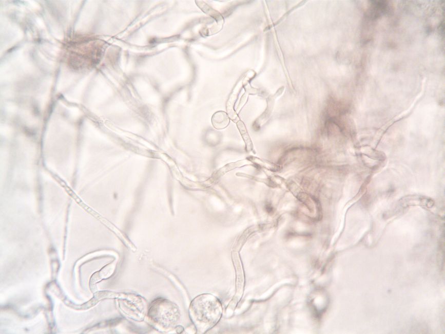 How Do I Identify and Correct Single-Cell Depressions in a DEM?
