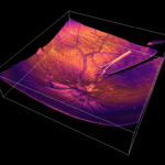 Precision Surgery Technologies: How Advanced Tools Transform Modern Medicine