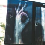 How Artificial Intelligence is Transforming Injury Risk Assessment and Prevention